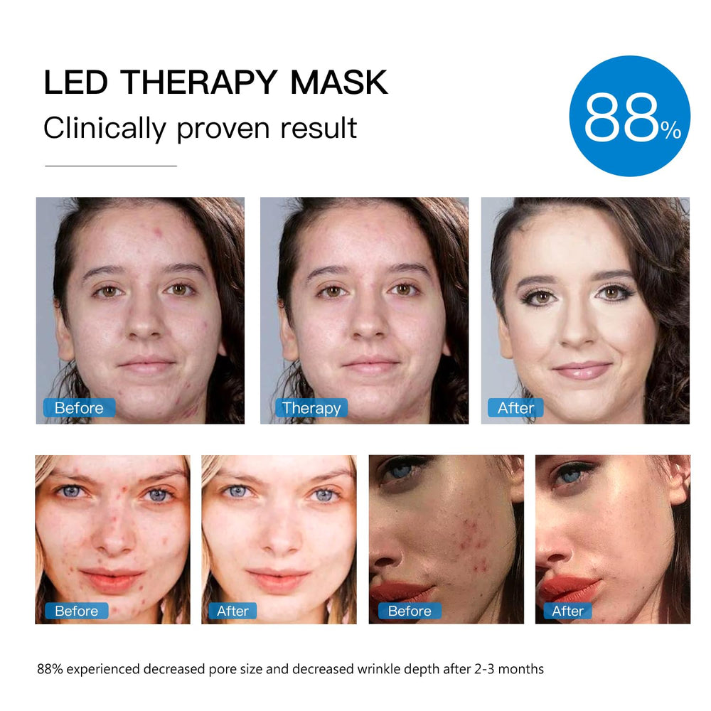 IOBTY maize-yellow LED mask in use with blue and red LEDs for skincare