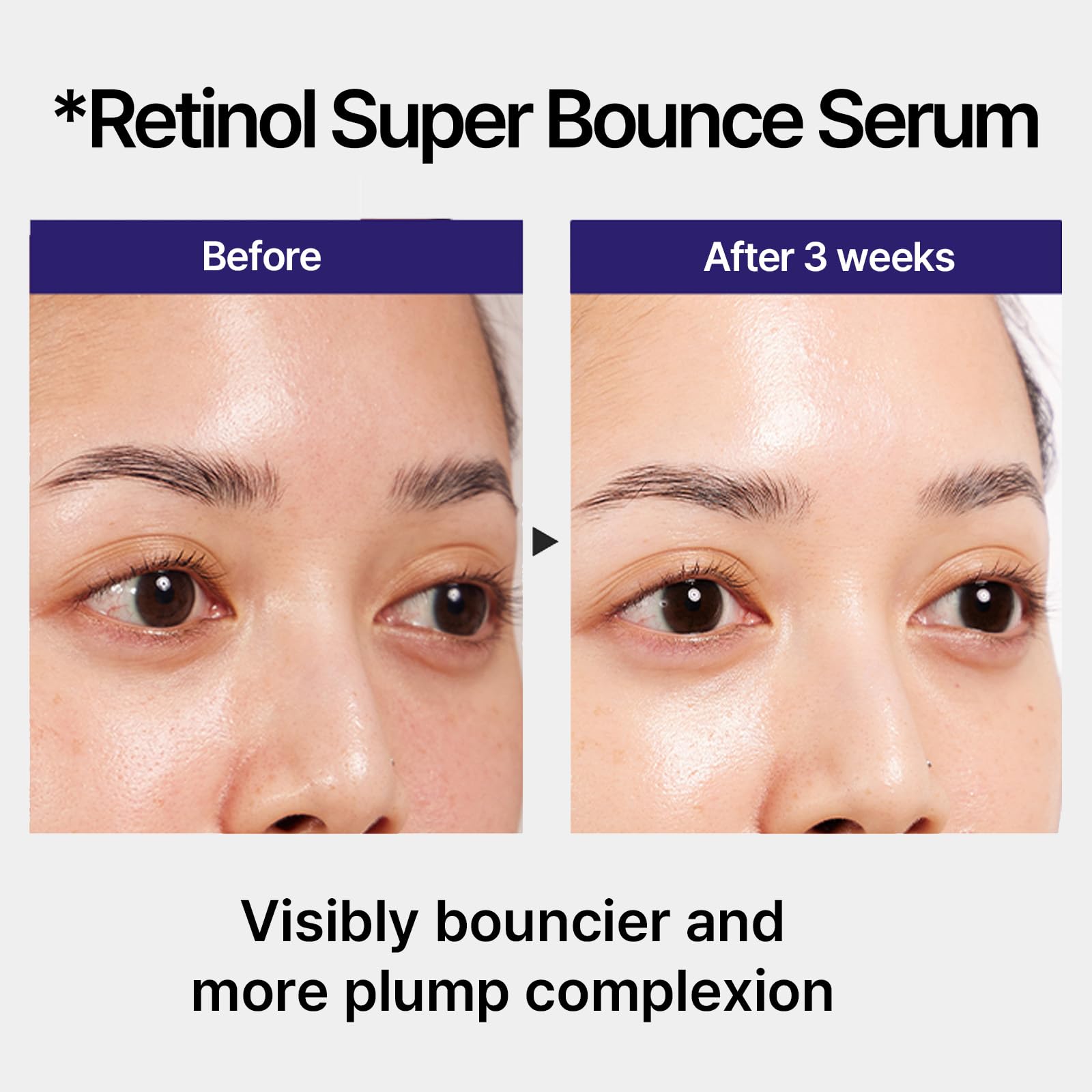 IOPE Retinol Super Bounce Serum with cypress leaf soothes skin during daily use