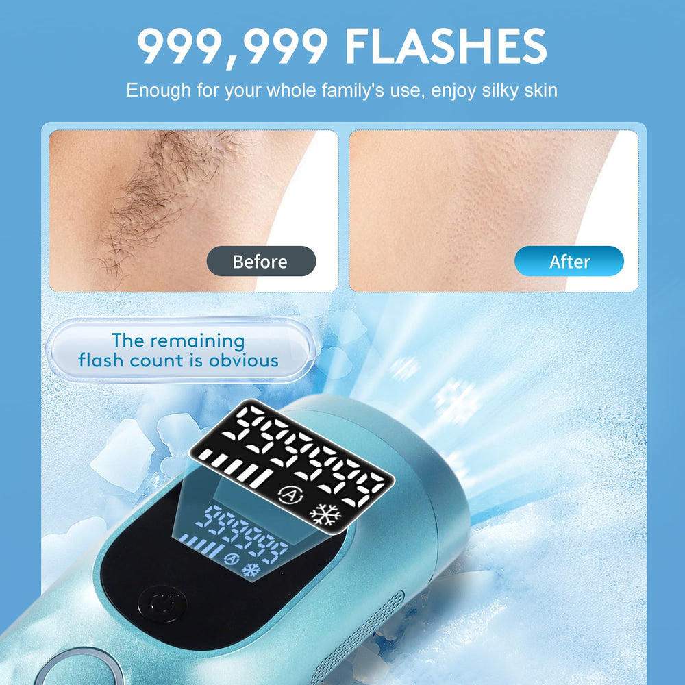 Iouniya manual mode provides precise control for bikini lines and face.
