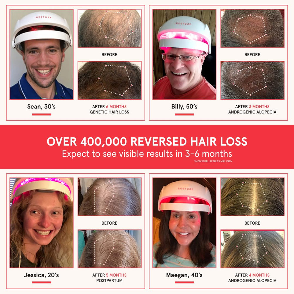 iRestore Essential closeup of laser diodes for targeted red-light hair growth