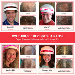 iRestore Essential closeup of laser diodes for targeted red-light hair growth