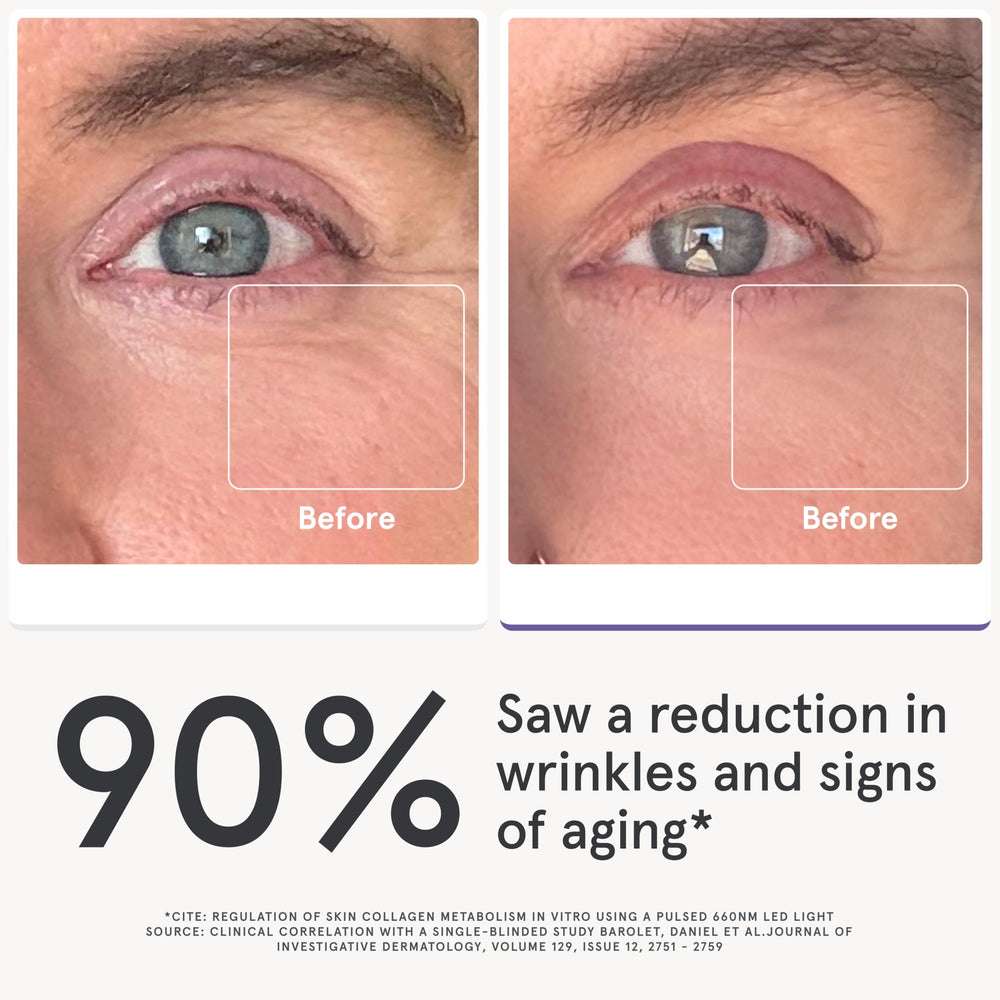 iRestore eye mask LED close-up highlighting dense LED array for eye-area care