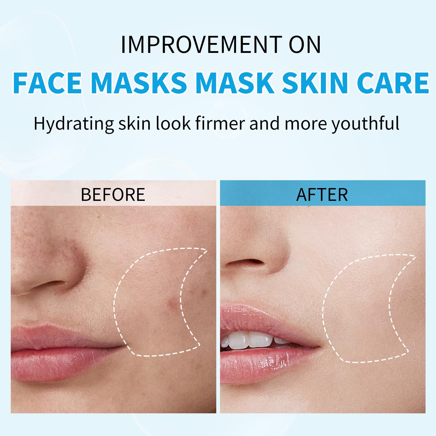IREV After Sun Face Mask providing quick hydration after sun exposure.