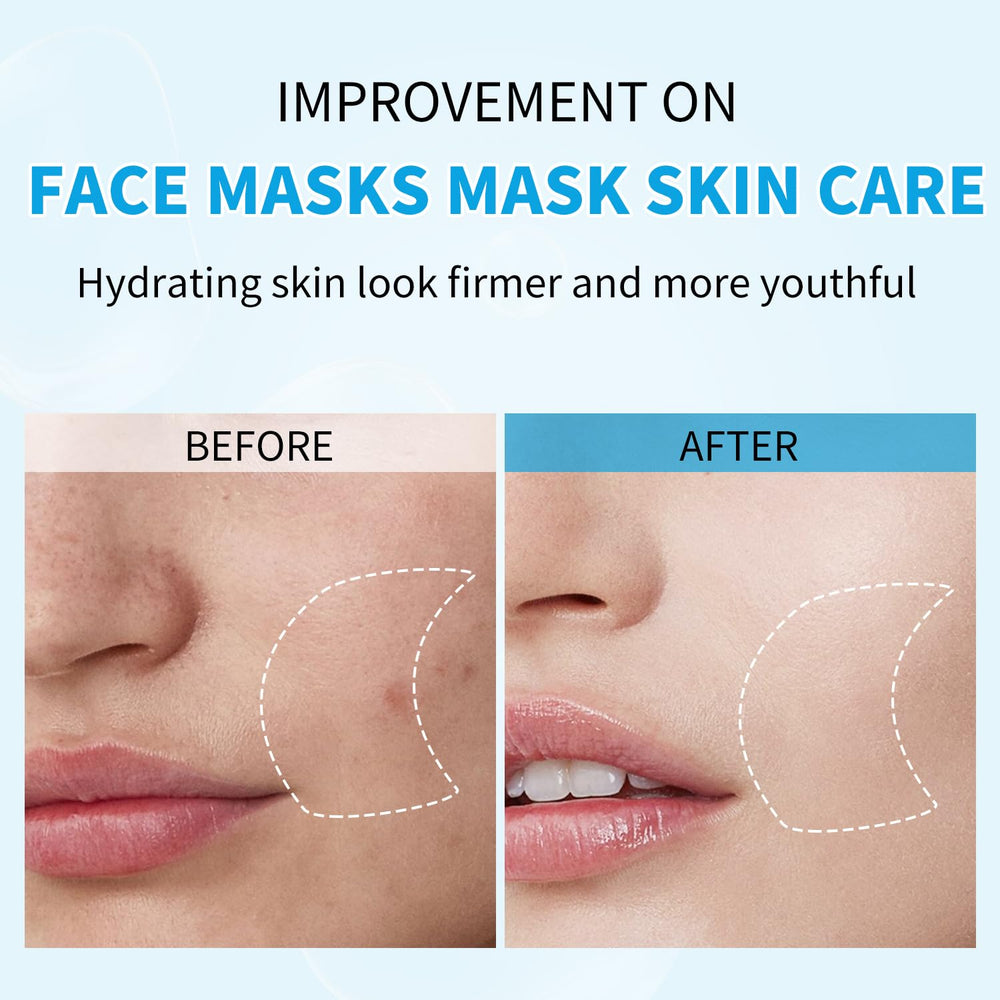 IREV After Sun Face Mask providing quick hydration after sun exposure.