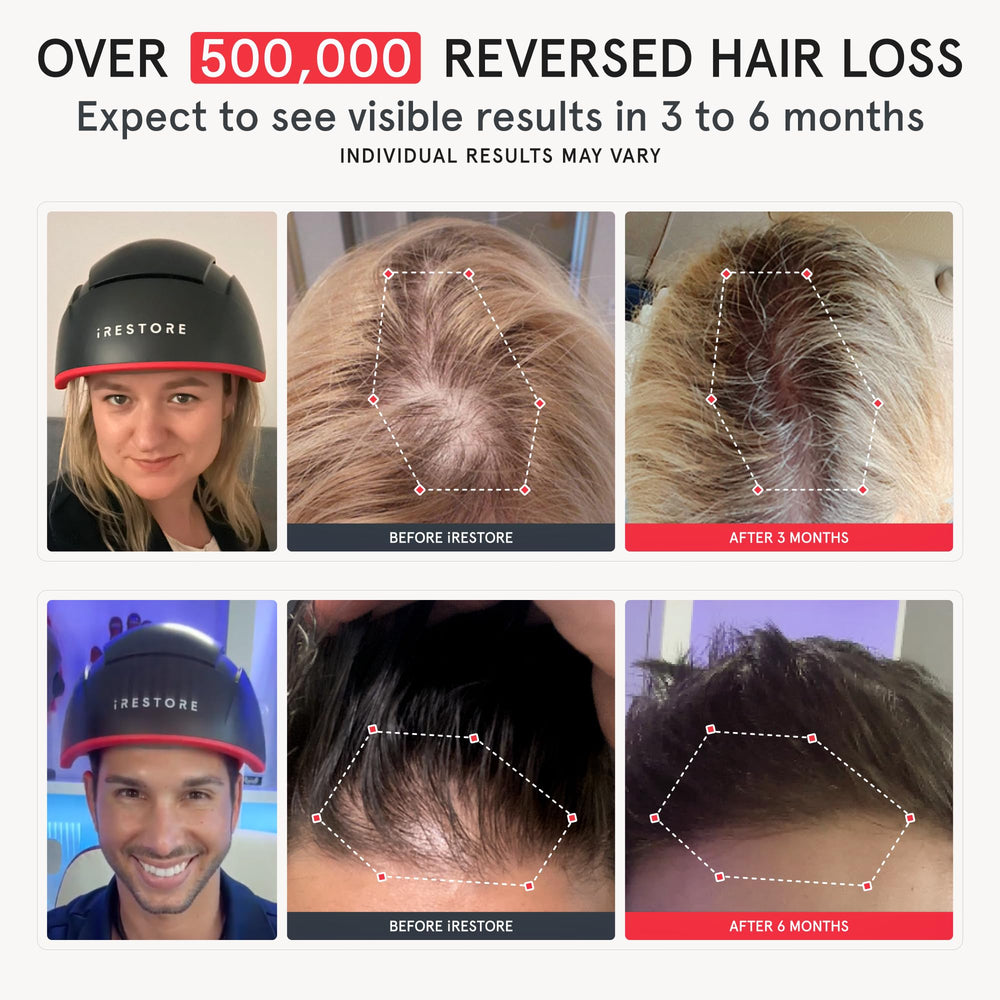 iRestore Elite worn on head during daily routines for convenience