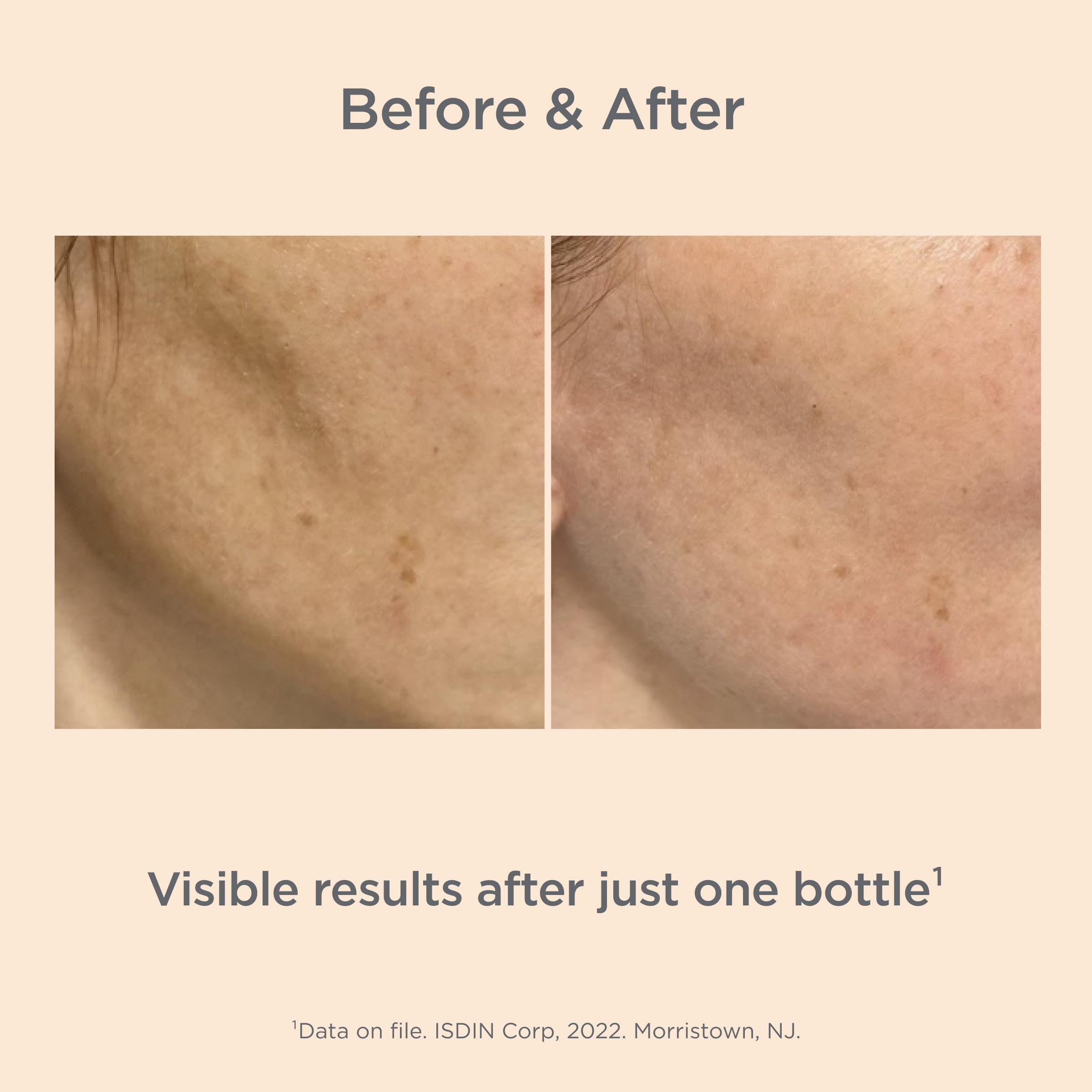 ISDIN Melaclear Advanced texture close-up highlighting quick absorption on skin.