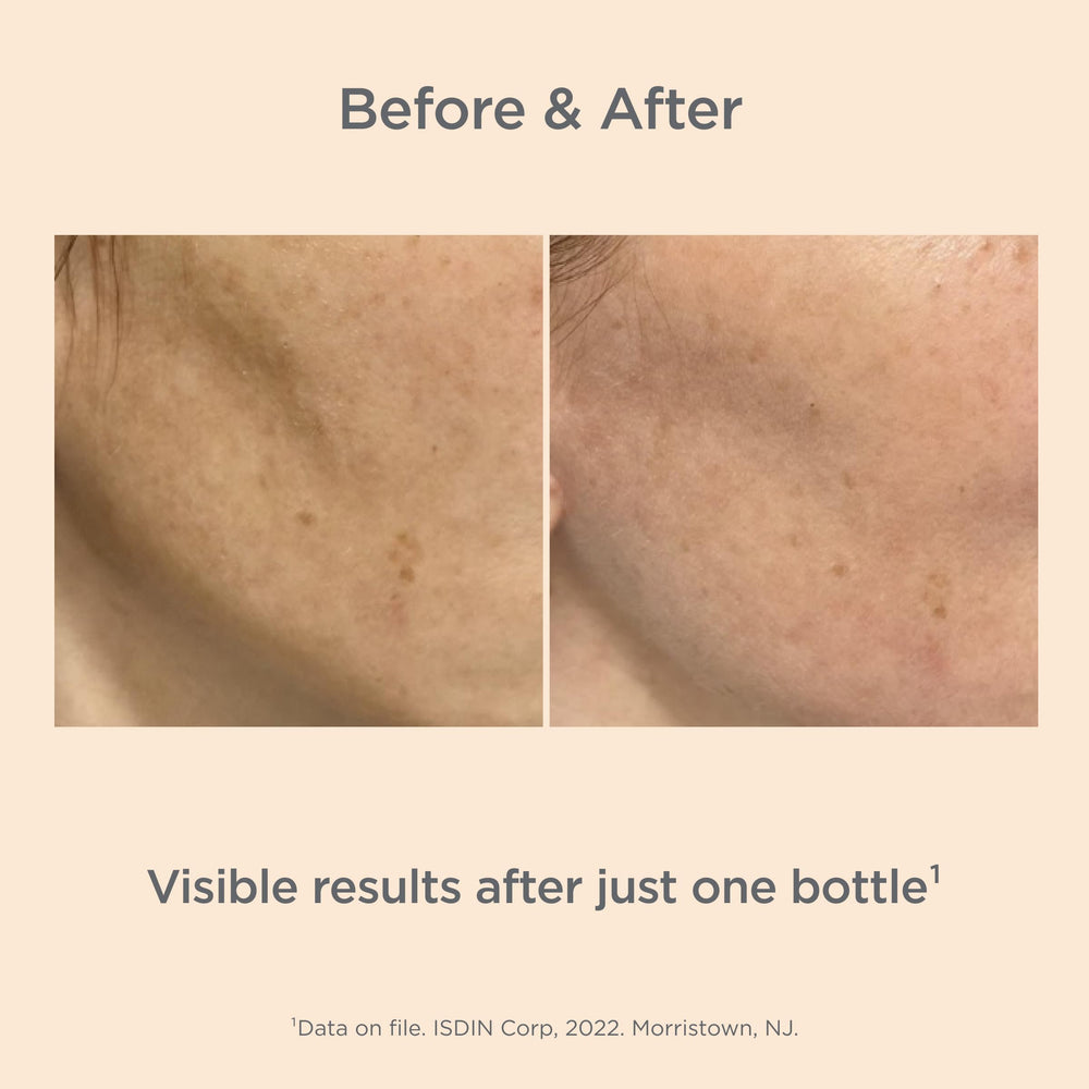 ISDIN Melaclear Advanced texture close-up highlighting quick absorption on skin.