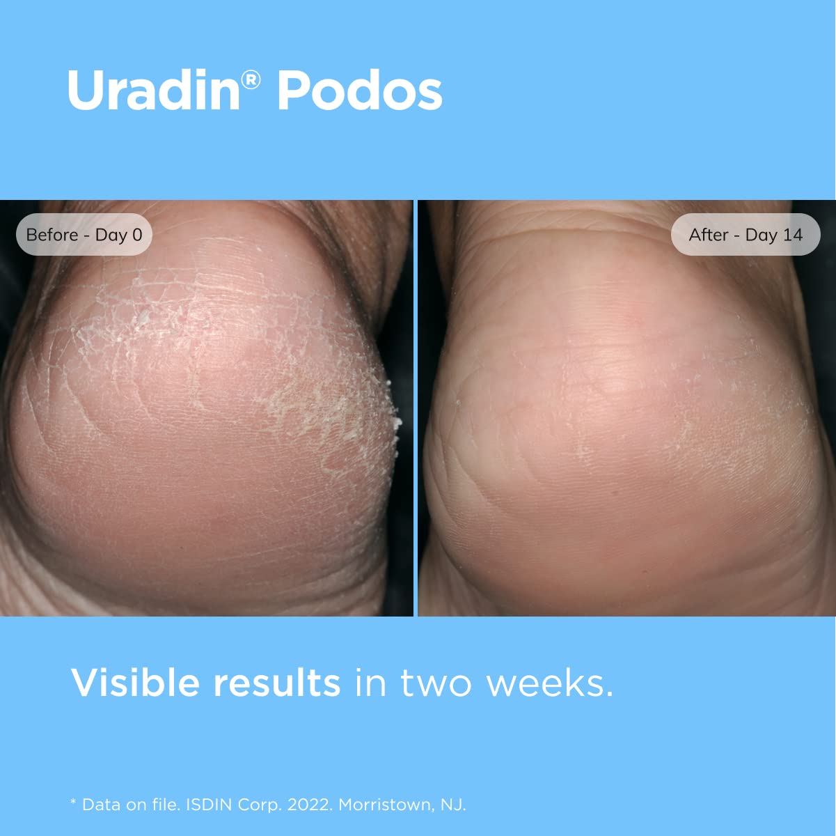 ISDIN Uradin Podos hyaluronic acid detail on bottle
