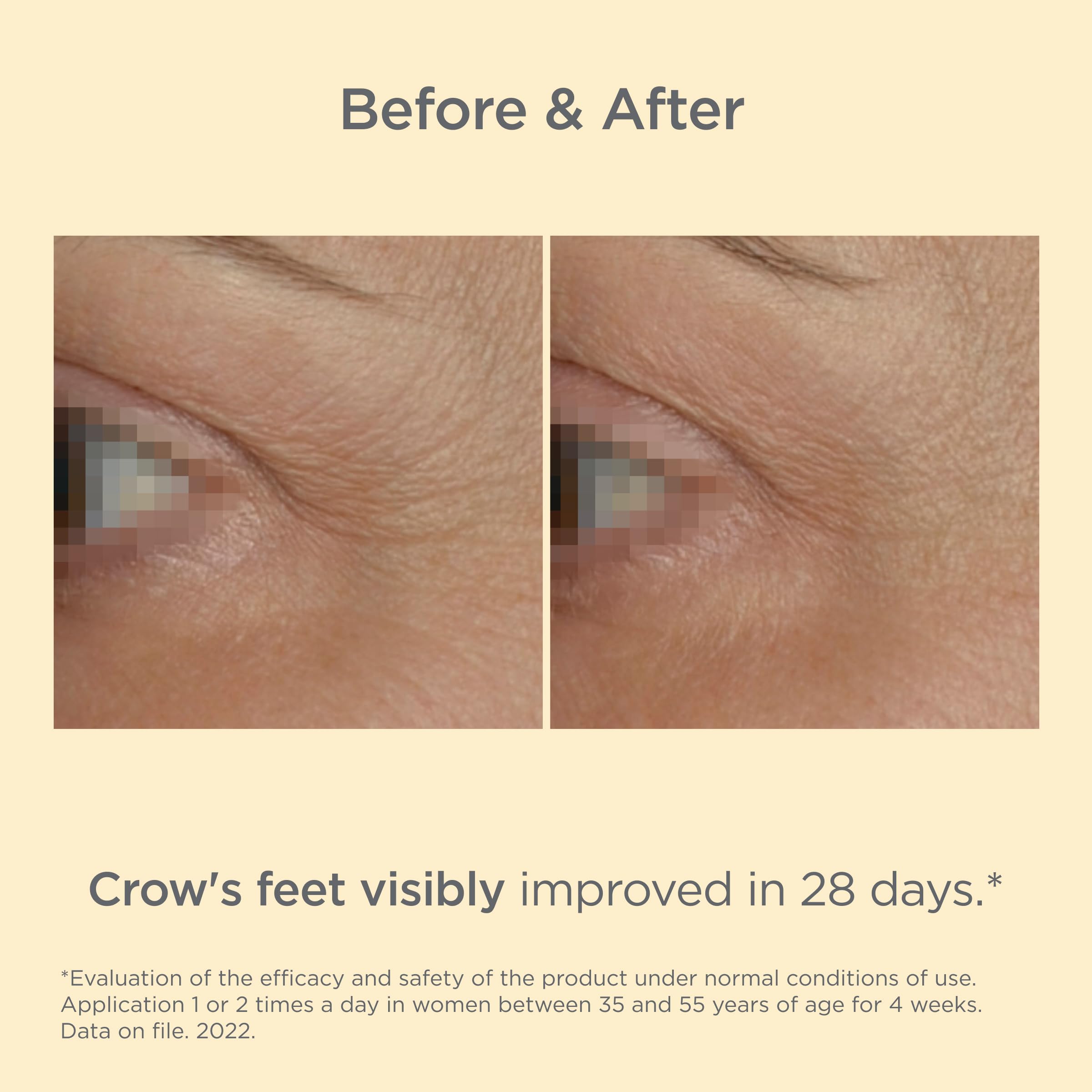 ISDIN Vital Eyes applicator close-up focusing on cooling tip.