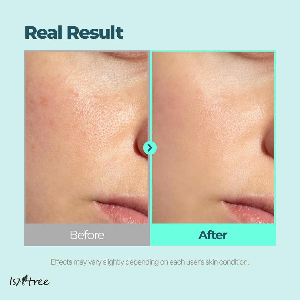 IsNtree Gim PDRN Hydro Bouncy Ampoule drop on hand demonstrates quick absorption.