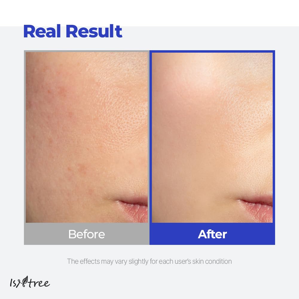 IsNtree Hyaluronic Acid Aqua Gel Cream under-makeup application for smooth layering