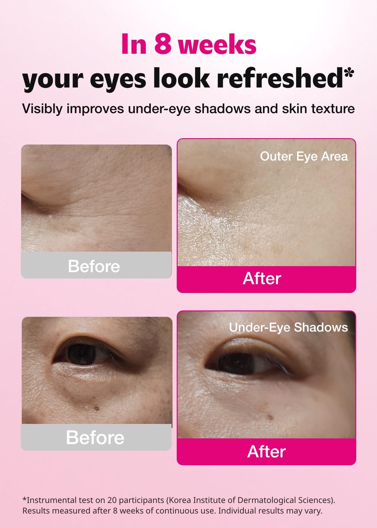 ISOI blemish care under-eye patch texture detail highlights gentle hydrogel feel.