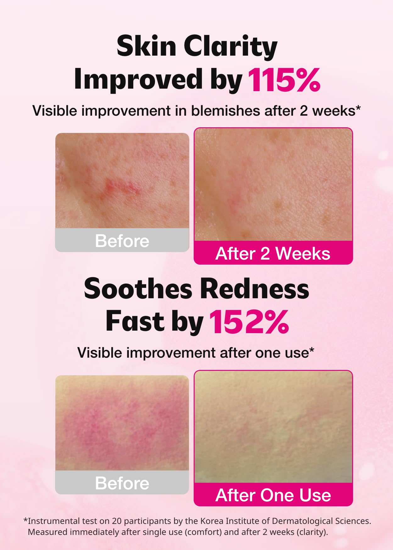 ISOI Blemish Care Up Serum Rose Otto visual suggests soothing, aromatic skincare benefits.