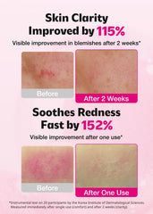 ISOI Blemish Care Up Serum Rose Otto visual suggests soothing, aromatic skincare benefits.