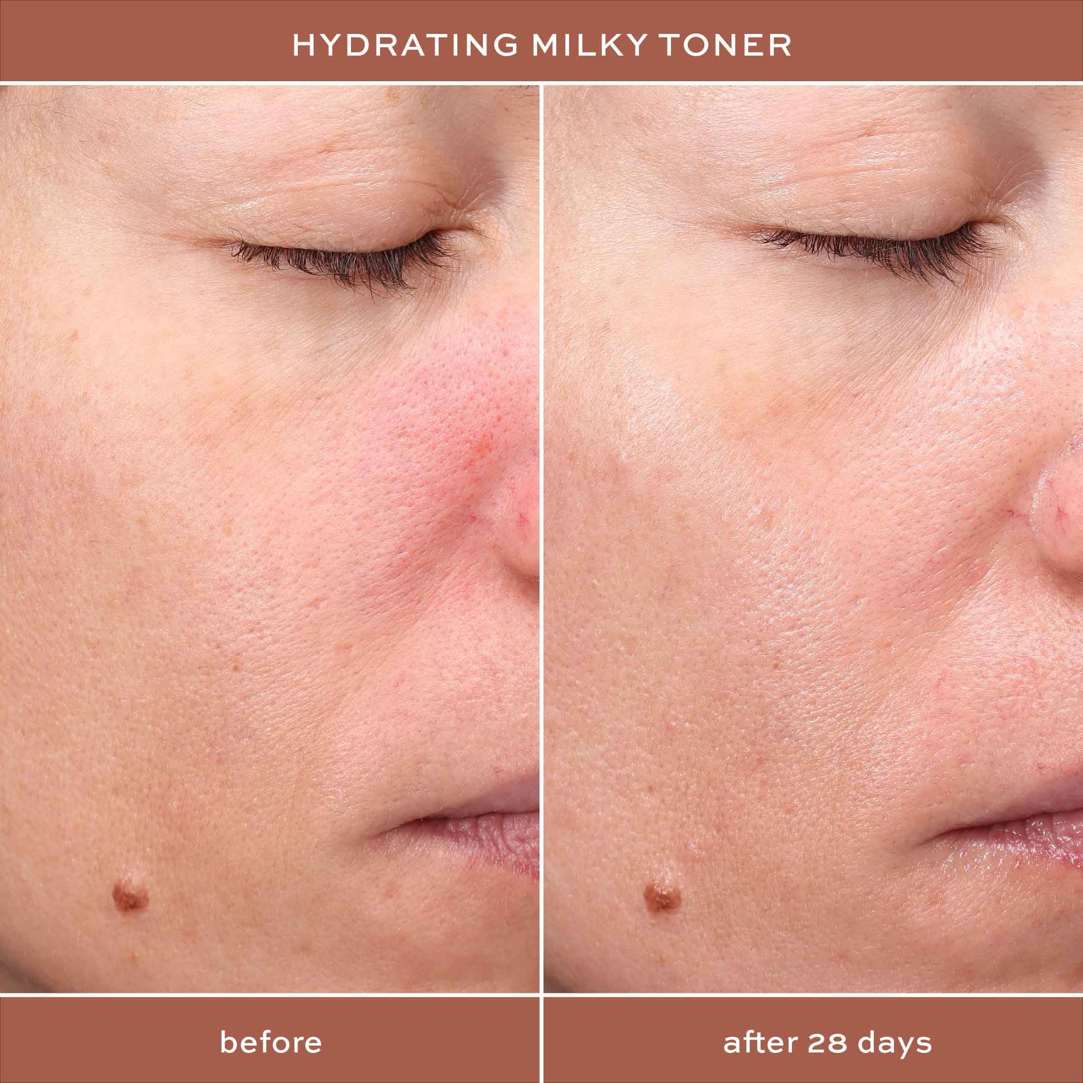ITK Toner on cotton pad preps skin for serum and moisturizer