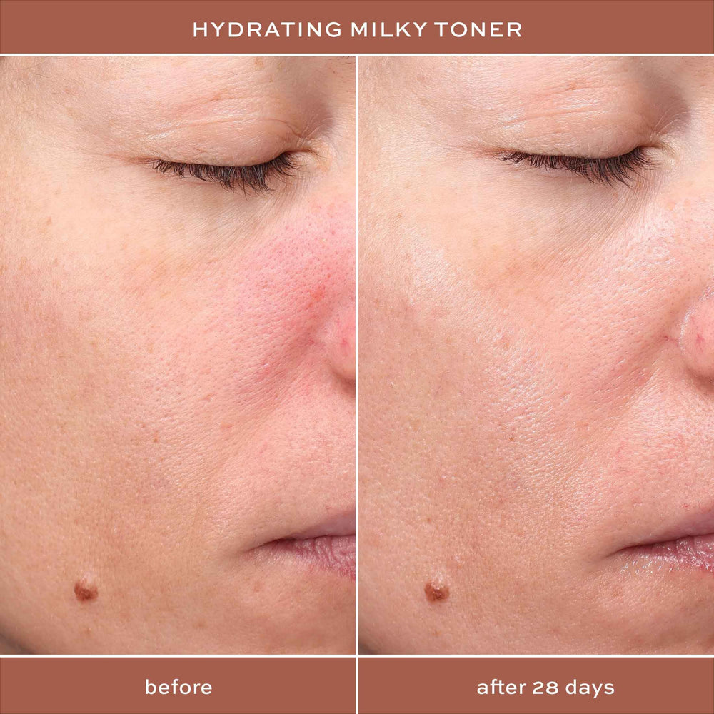 ITK Toner on cotton pad preps skin for serum and moisturizer
