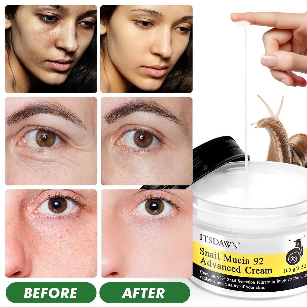 ITSDAWN Snail Mucin 92% cream being applied to the face for smooth absorption
