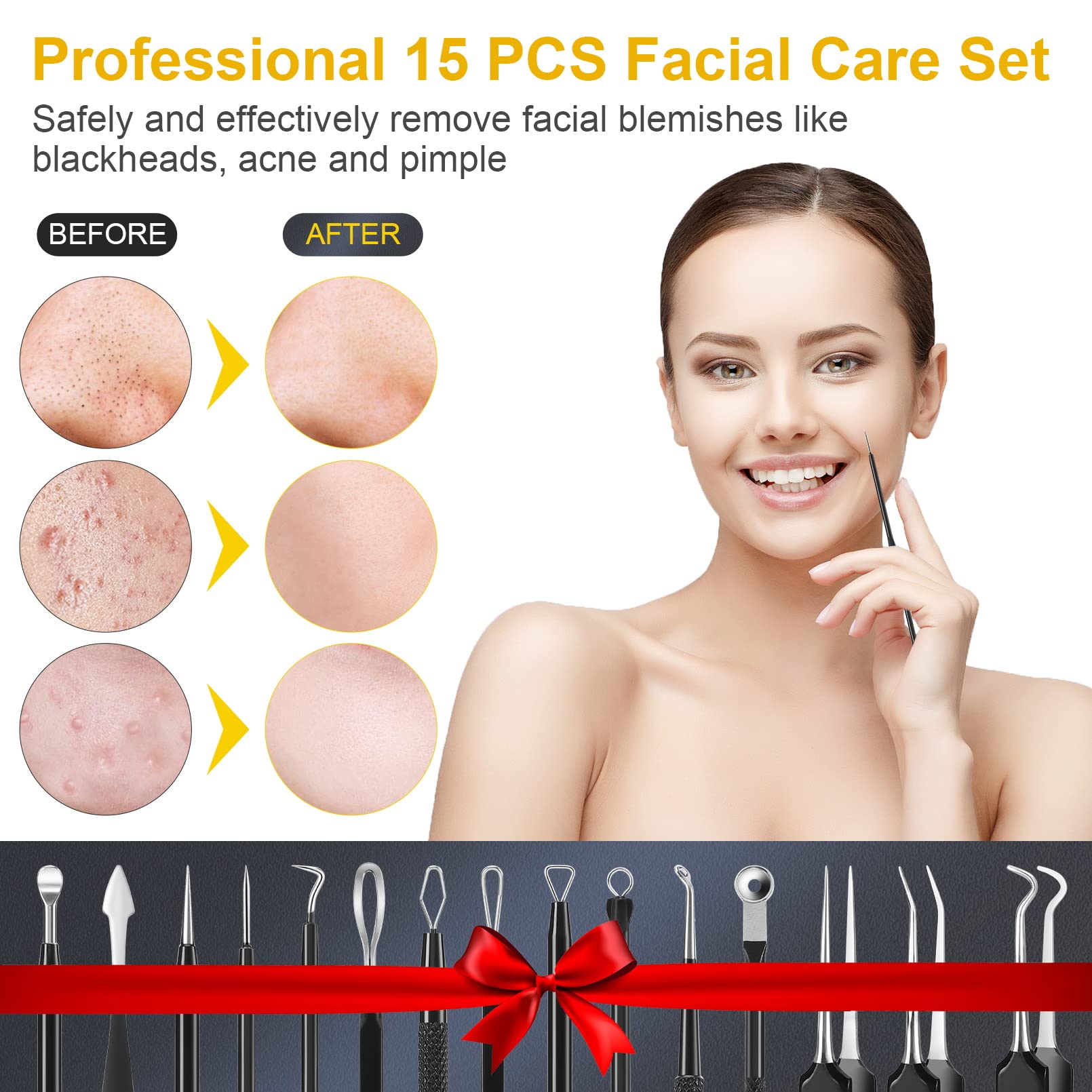 IUMAKEVP blackhead remover tool close-up for targeted pore cleansing