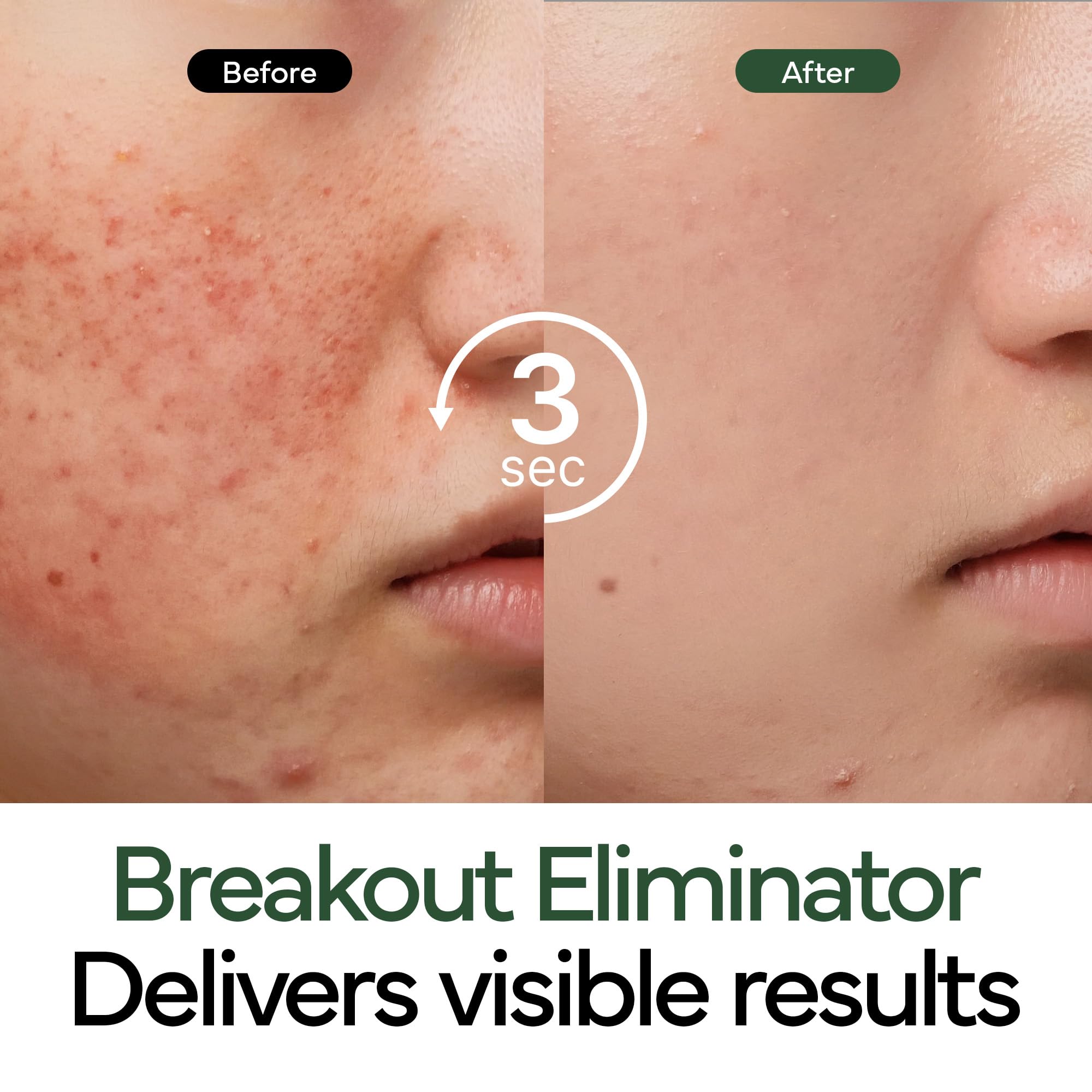 IVOSKIN Ceramides and Hyaluronic Acid illustrate barrier-supporting hydration in action.