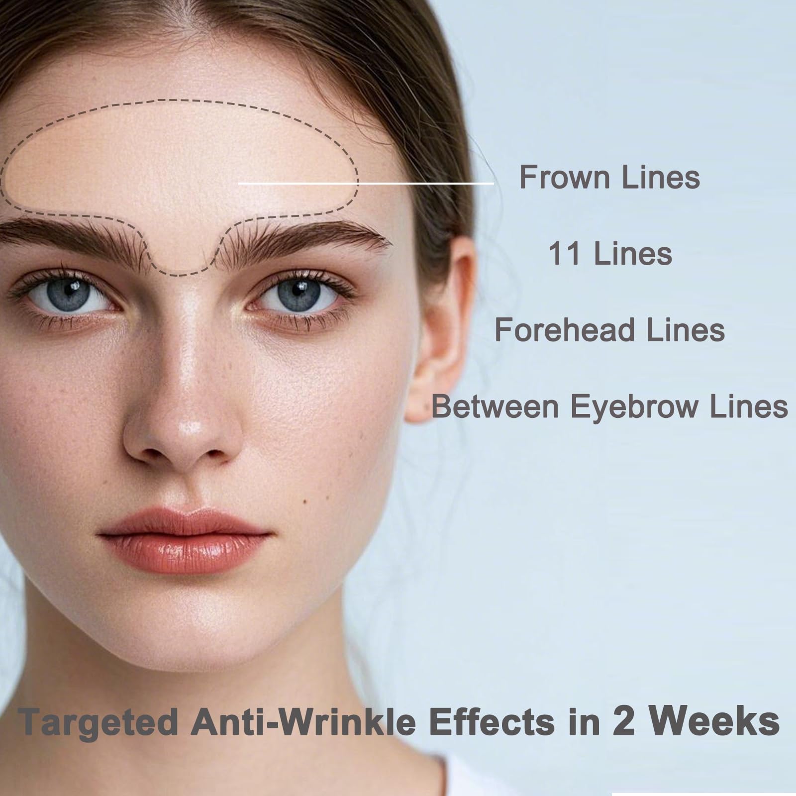 IyxicmI glabellar lines patch extends to mid-nasal bridge for full-area coverage.
