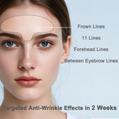 IyxicmI glabellar lines patch extends to mid-nasal bridge for full-area coverage.