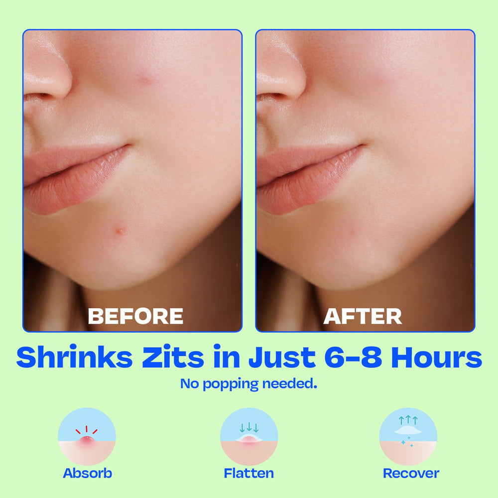 JB SKRUB pimple patches discreet matte finish blends with skin for subtle wear.