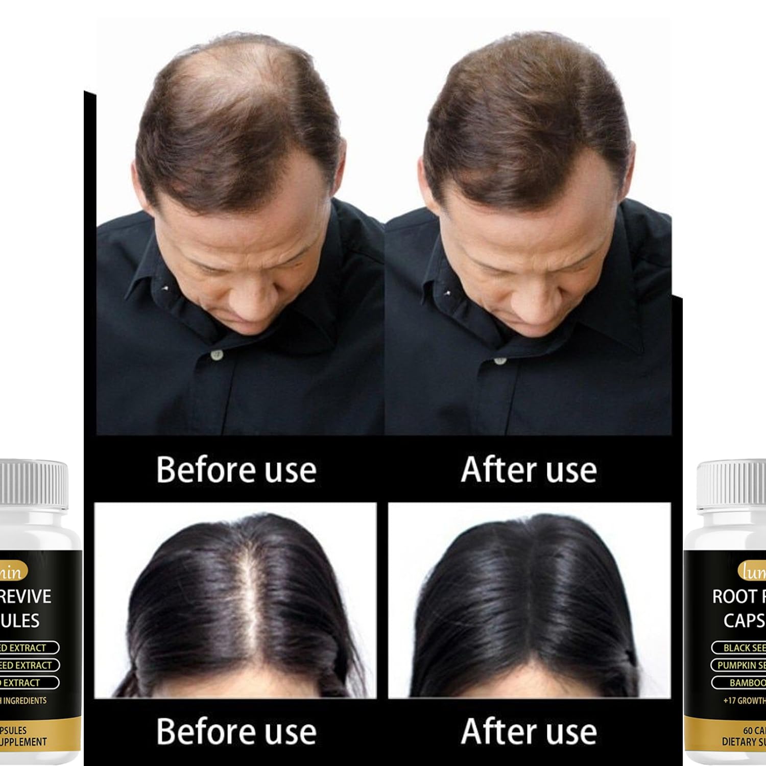 JcuffJ Lumin Root Revive packaging box shows premium hair-support supplement.