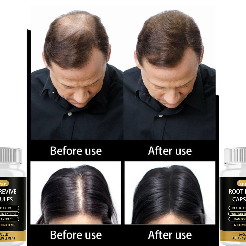 JcuffJ Lumin Root Revive packaging box shows premium hair-support supplement.