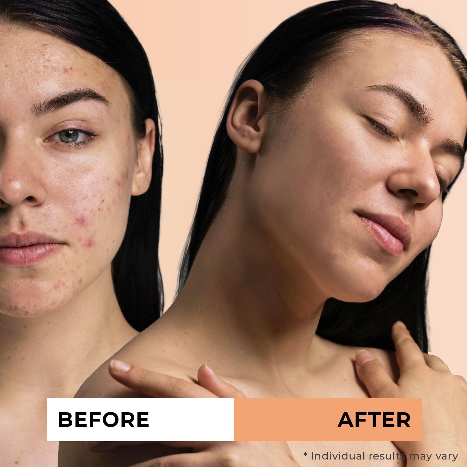 Jeune Naturelle Sea Buckthorn Oil ingredients card highlights vitamin-rich purity.