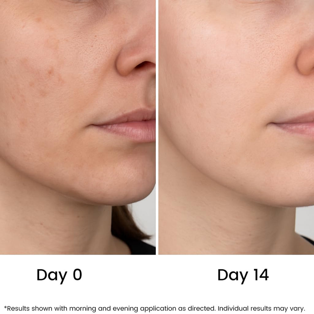 Jeune Naturelle Vitamin C Serum label close-up shows clean, natural formula.