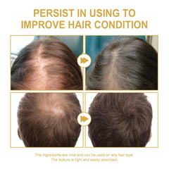 JISKG EELHOE oil dropper over scalp supports nourishment.