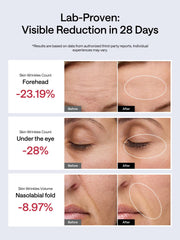 JMOON M30U eye and smile-line focus for targeted results.