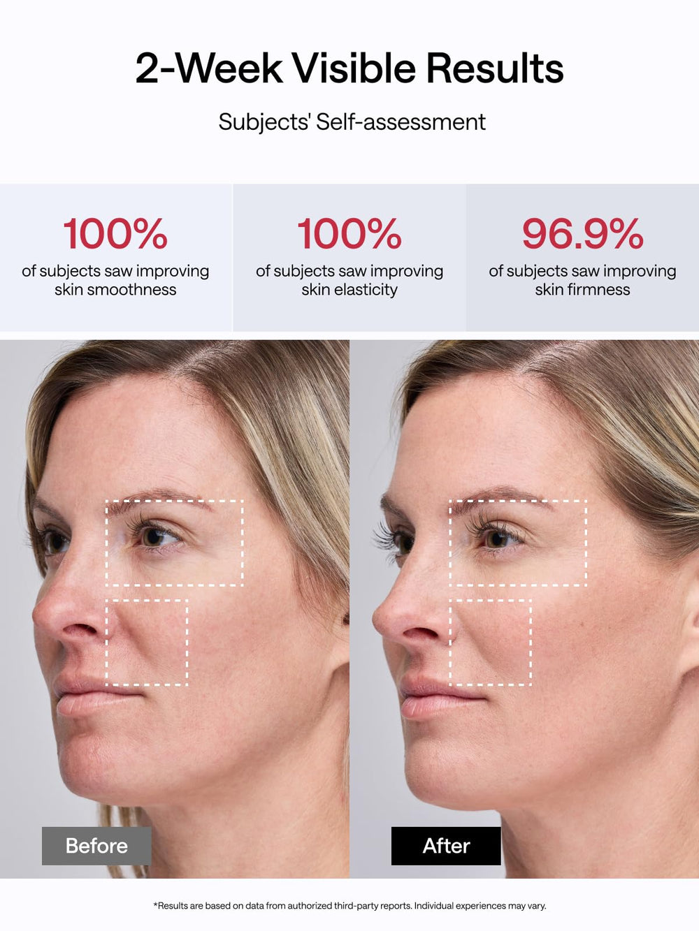 JMOON M30U full-face toning for firmer skin.