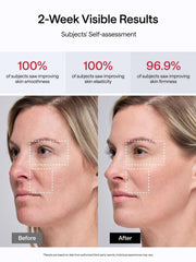 JMOON M30U full-face toning for firmer skin.