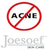 JOESOEF Sulfur Soap use in acne and rosacea routine illustration.