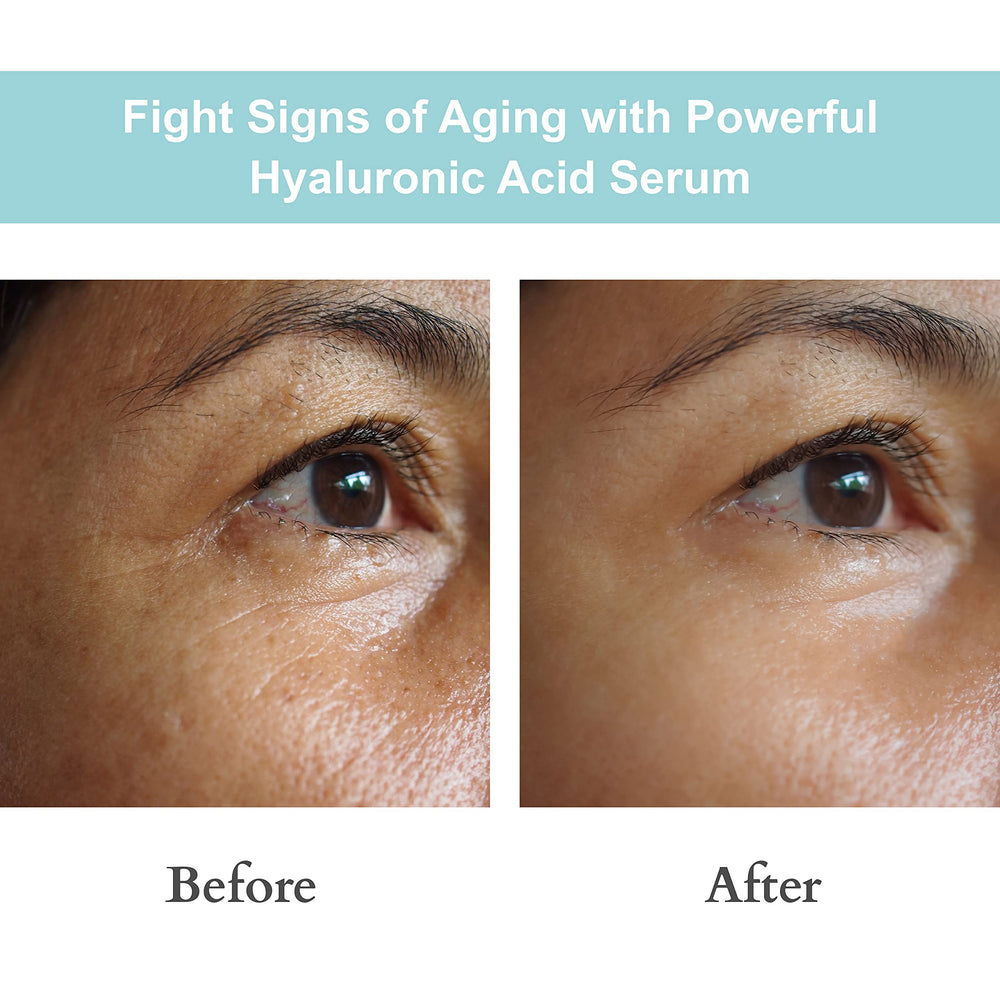 JOYAL BEAUTY Hyaluronic Serum on lips provides smooth hydration.