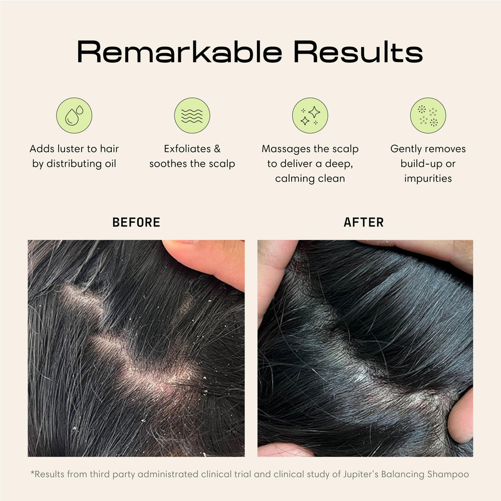 Jupiter Scalp Exfoliator wet-use bristles deliver spa-like scalp cleanse.