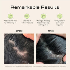 Jupiter Scalp Exfoliator wet-use bristles deliver spa-like scalp cleanse.