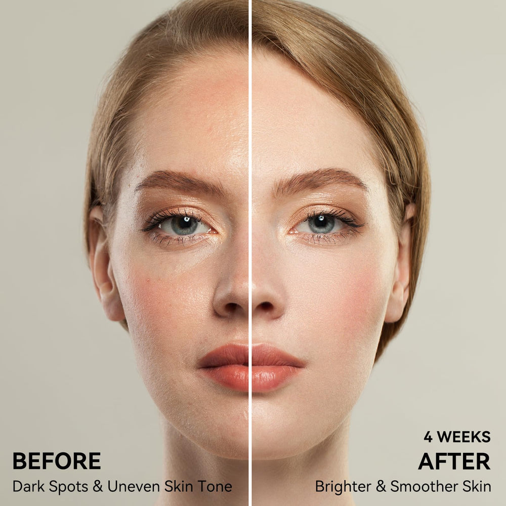 JURVEW Rapid Spot Remover bottle for at-home treatment of uneven skin tone.