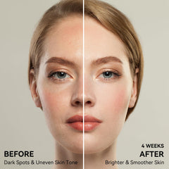 JURVEW Rapid Spot Remover bottle for at-home treatment of uneven skin tone.