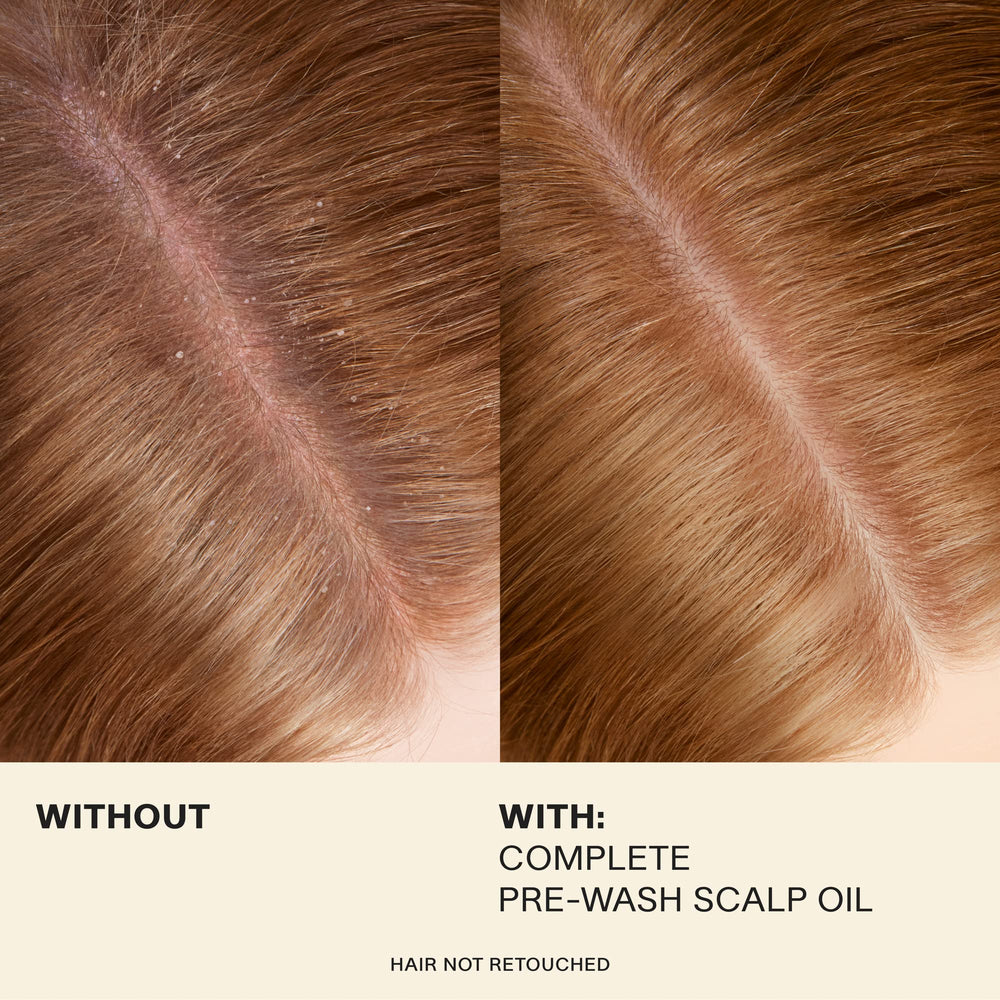 JVN Complete Pre-Wash Scalp Oil applied to scalp during massage supports healthier circulation