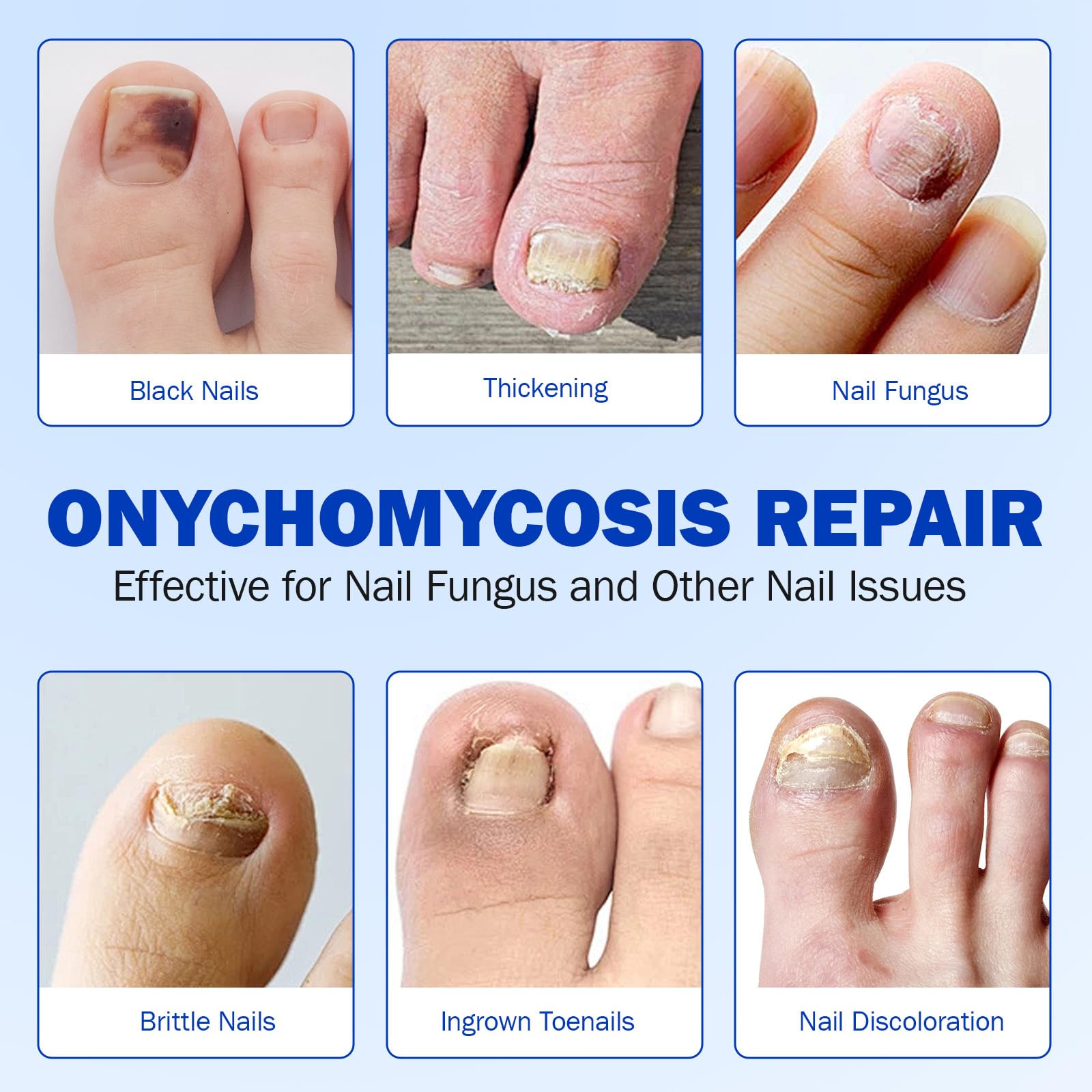 JWBVCTCR nail patches night care demonstrates deep nourishment while you sleep