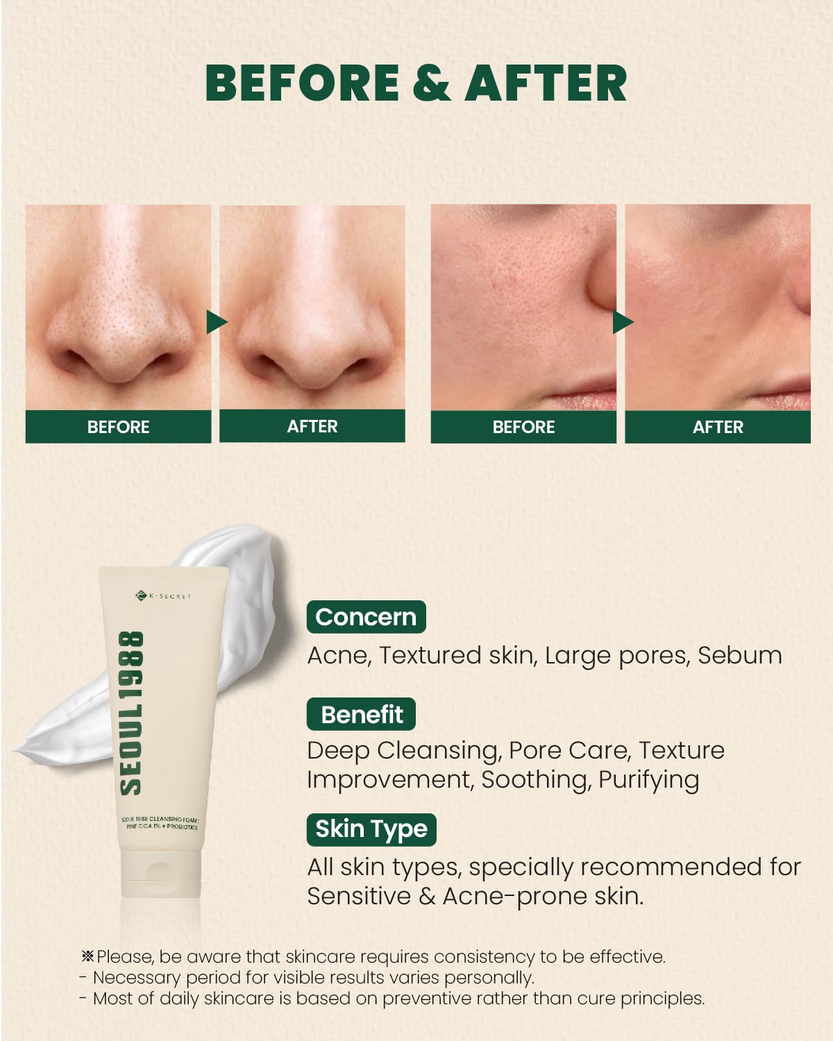 K-SECRET SEOUL 1988 Cica Foam probiotic formula preserves moisture