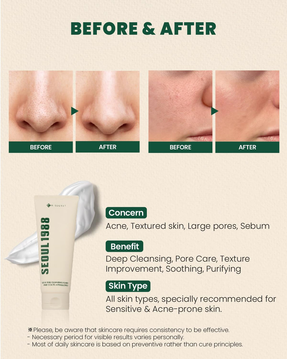 K-SECRET SEOUL 1988 Cica Foam probiotic formula preserves moisture