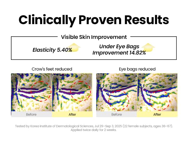 K-SECRET Seoul 1988 fermented bean complex image hints at antioxidant boost.