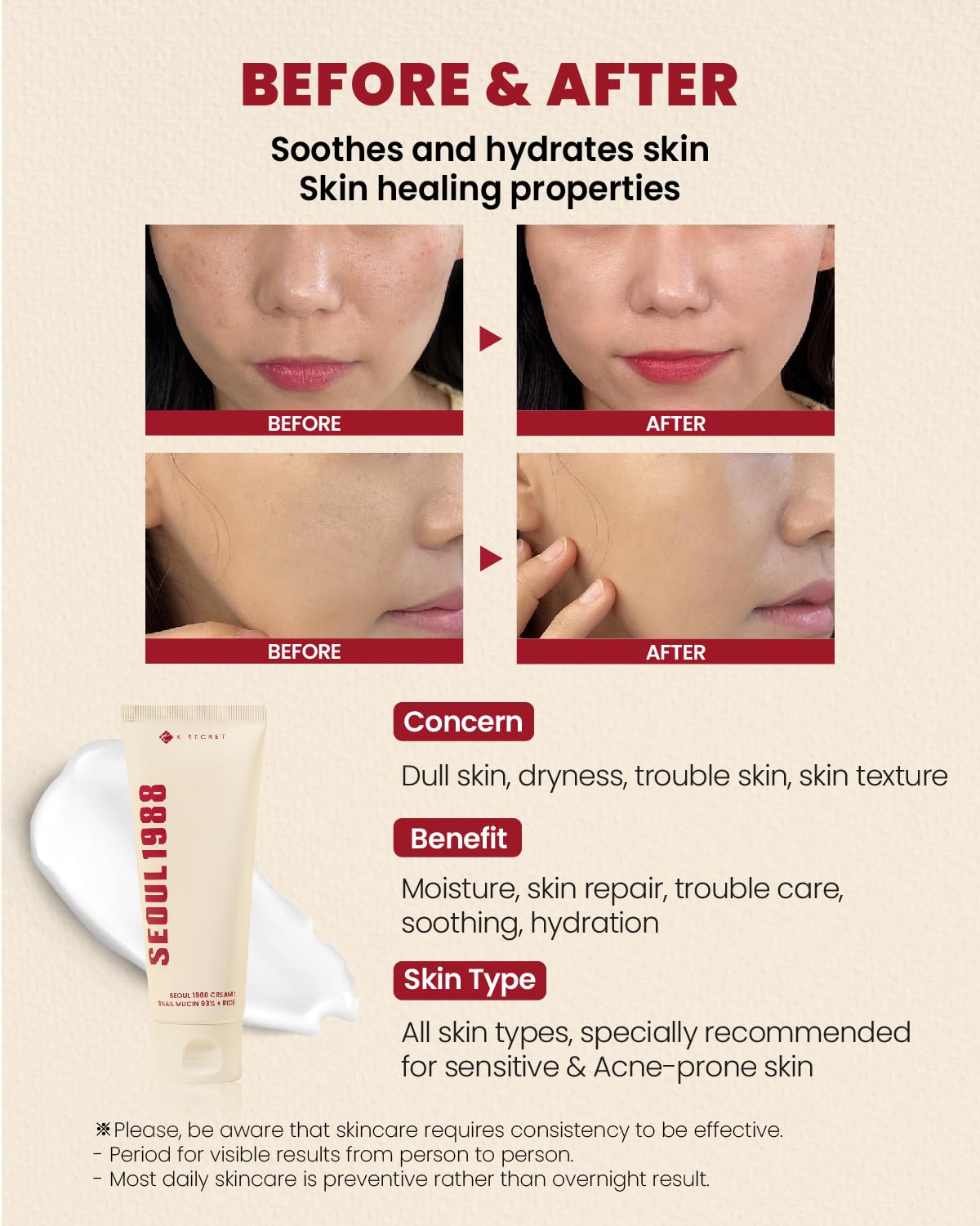K-SECRET Seoul 1988 snail mucin cream packaging showcases premium skincare.