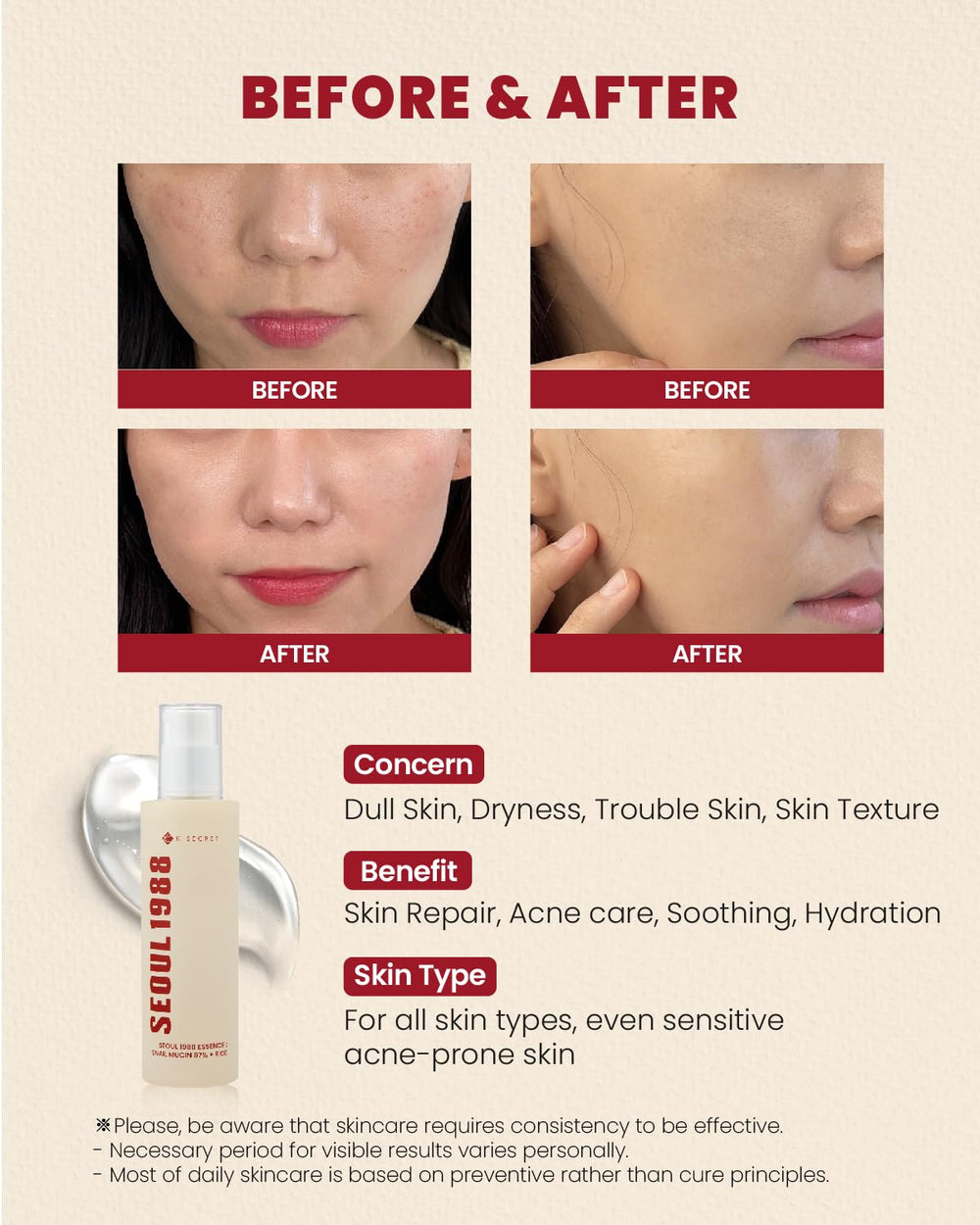 K-SECRET snail mucin 97% essence on forearm showing soothing, moisture-rich feel.