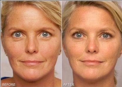 K6 Skin Care Retinol Gel targets wrinkles and fine lines during nightly routine.
