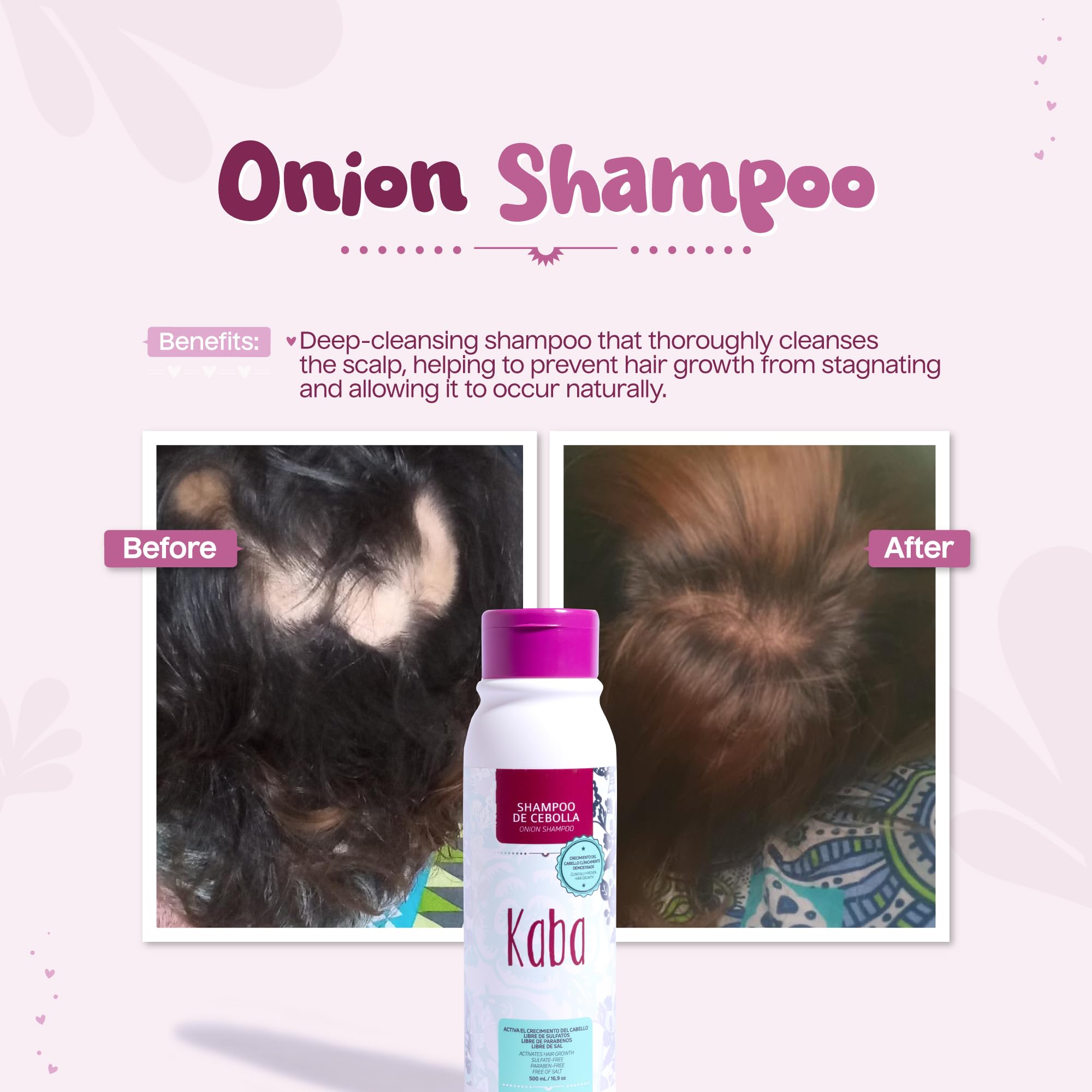 Kaba Red Onion Shampoo ingredient label shows rosemary and ginger, highlighting botanical nourishment
