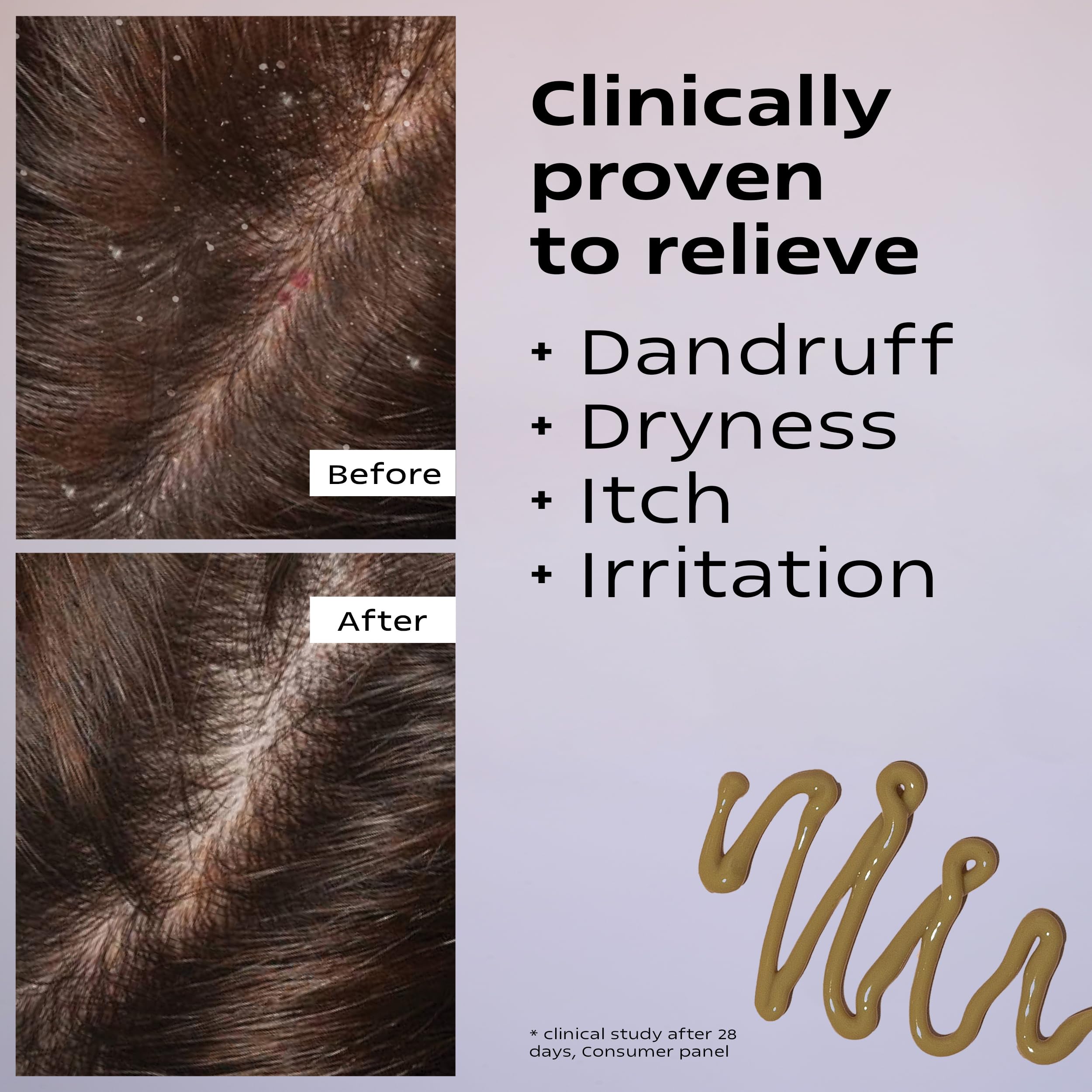 KAMEDIS Scalp Moisturizer Lotion overnight ritual suggests calmer mornings